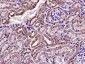 VDAC1 Recombinant Rabbit mAb, Mitochondrial Loading Control